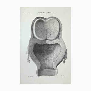 Ottavio Muzzi, Uterus Diseases, Lithograph, 1843