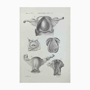Ottavio Muzzi, Uterus Diseases, Lithograph, 1843