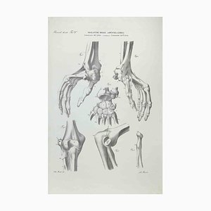 Ottavio Muzzi, Joint Diseases, Lithograph, 1843