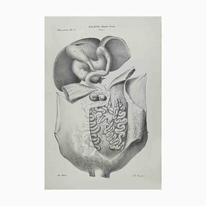 Ottavio Muzzi, Veins Diseases, Lithograph, 1843