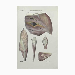 Ottavio Muzzi, Muscles Diseases, Lithograph, 1843