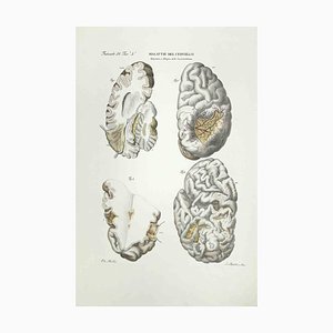 Ottavio Muzzi, Brain Diseases, Lithograph, 1843