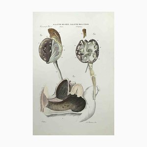 Ottavio Muzzi, Kidney Diseases & Uterus Diseases, Lithograph, 1843