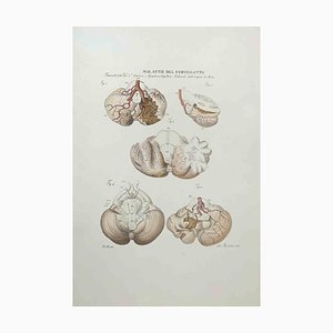 Ottavio Muzzi, Diseases of the Cerebellum, Lithograph, 1843