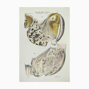 Ottavio Muzzi, Stomach Diseases, Lithograph, 1843