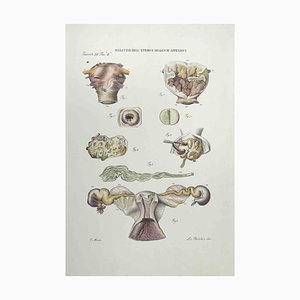 Ottavio Muzzi, Diseases of the Uterus and its Appendages, Lithograph, 1843