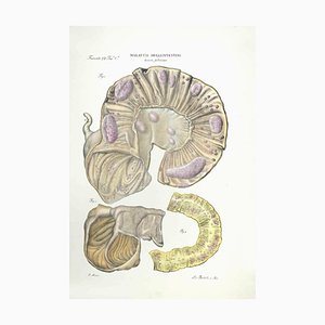 Ottavio Muzzi, Diseases of the Intestines, Lithograph, 1843