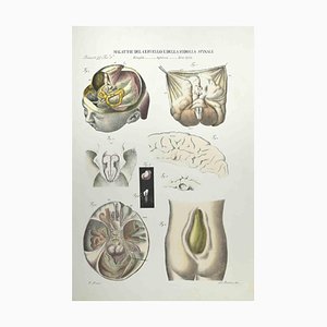 Ottavio Muzzi, Diseases of the Brain and Spinal Cord, Lithograph, 1843