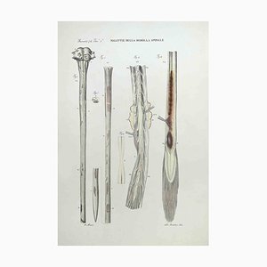 Ottavio Muzzi, Enfermedades del cerebro y la médula espinal, Litografía, 1843