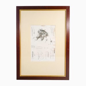C. Pastore, Chirurgie Ophtalmique, Italie, 1800, Estampe