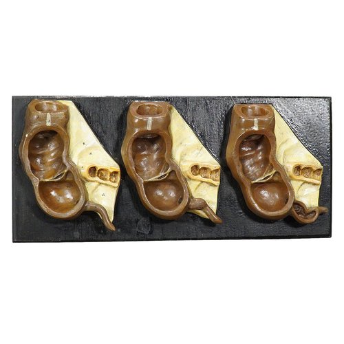 Appendix In Life Model Antique Teaching Model Stages of the Appendix, 1900s for sale at Pamono