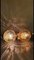 Milchglas Hängelampe und Wandleuchten Set von Doria Leuchten 18