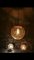 Milchglas Hängelampe und Wandleuchten Set von Doria Leuchten 4