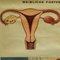 Vintage Female Genital Tract Pull Down Wall Chart 2