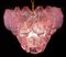 Lámparas de araña italianas de concha rosa, Murano. Juego de 2, Imagen 5