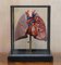 Vintage Anatomical Model of Human Lungs in Display Case, Image 2