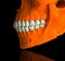 Mr Strange, Orange Skull, 2021, Impression Giclée sur Panneau Aludibond 2
