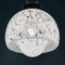 Mid-Century White Murano Pendant Lamp by Carlo Nason for Mazzega, Italy, 1960s 11