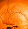 Mr Strange, Orange Skull, 2021, Impression Giclée sur Panneau Aludibond 4