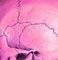 Mr Strange, Pink Skull, 2021, Giclée Druck auf Aludibond Platte 4