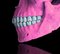 Mr Strange, Pink Skull, 2021, Giclée Print on Aludibond Panel, Immagine 2
