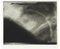 Norman Ackroyd, Various Compositions, 1970s, Etchings, Framed, Set of 4 7