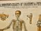 Grand Tableau de Ligamnets Anatomique d'Université par Turner, 1920s 2