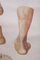 Póster médico desplegable vintage que ilustra la ortopedia del pie, 1935, Imagen 5