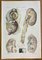 Ottavio Muzzi, Kidney Diseases, Lithograph, 1843 1