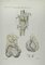 Ottavio Muzzi, Joint Diseases, Lithograph, 1843 1