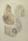 Ottavio Muzzi, Bowel Diseases, Lithograph, 1843 1