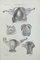 Ottavio Muzzi, Uterus Diseases, Lithograph, 1843 1