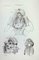 Ottavio Muzzi, Fetus Diseases, Lithograph, 1843 1