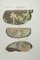 Ottavio Muzzi, Liver Diseases, Lithograph, 1843 1