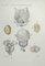 Ottavio Muzzi, Bladder and Prostate Diseases, Lithograph, 1843 1