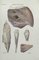 Ottavio Muzzi, Muscles Diseases, Lithograph, 1843 1
