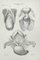 Ottavio Muzzi, Uterus Diseases, Lithograph, 1843 1