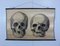 Charte Murale Scolaire de Crânes Anatomique par G Helbig, 1930s 6
