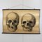 Anatomical School Wall Chart of Skulls by G Helbig, 1930s 1