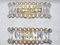 Lead Crystal Sconces from Bakalowits & Söhne, 1960s, Set of 2 1